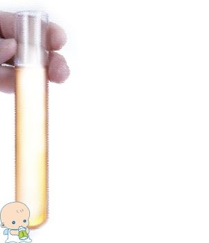 体外受精 IVF-ET